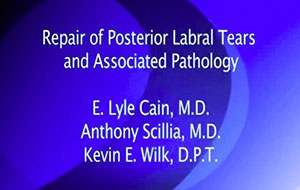 Posterior Labral Repair